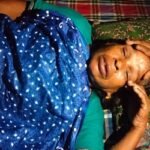 মাঙ্কিপক্সের উপসর্গ, চুয়াডাঙ্গায় আইসোলেশনে নারী