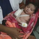 অলৌকিকভাবে বেঁচে যাওয়া সেই শিশুটি জন্ডিসে আক্রান্ত