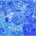 লাসা ভাইরাস: করোনার চেয়ে যাকে বেশি ভয় পান নাইজেরিয়ানরা