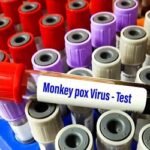 মাঙ্কিপক্সের নাম বদলে ‘ট্রাম্পের’ নামে রাখার প্রস্তাব