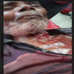 নোয়াখালীতে বৃদ্ধাকে গলা কেটে হত্যার চেষ্টা
