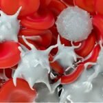 ডেঙ্গিজ্বরে প্লাটিলেট কমে যাওয়ার লক্ষণ, কী করবেন