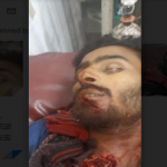 নোয়াখালীতে অটোরিকশা চালককে কুপিয়ে হত্যা, গ্রেফতার ২  