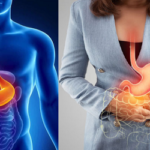 গ্যাস-অম্বল থেকে মুক্তি পেতে শীতকালে যেসব খাবার এড়িয়ে চলবেন