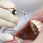 দাঁত তোলার আগে চিকিৎসককে কী কী জানিয়ে রাখতে হবে?