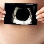 যে রোগে নিজেকে গর্ভবতী মনে করেন নারীরা