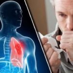 যে ১০টি উপসর্গে বুঝবেন ক্যান্সারের ঝুঁকি