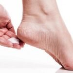 শীতে পা ফাটে? জেনে নিন সমাধান