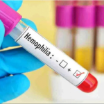 হিমোফিলিয়া নিয়ে কিছু কথা