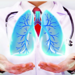 ফুসফুসে মাত্রাতিরিক্ত বাতাস
