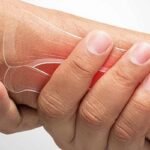 ক্যালসিয়ামের ঘাটতিতে শরীরে কী হয়?