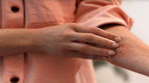 শীতে এলার্জির সমস্যা রোধে ৫ উপায়