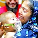 হাম ও হামের উপসর্গে শিশুমৃত্যু সাড়ে ৫শ ছাড়ালো