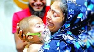 হাম ও হামের উপসর্গে শিশুমৃত্যু সাড়ে ৫শ ছাড়ালো