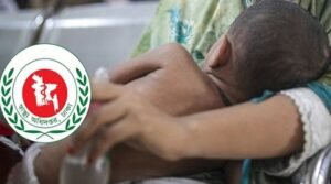 হাম উপসর্গে আরও ৬ শিশুর মৃত্যু, নতুন রোগী ১২৩১